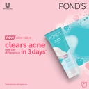 Ponds Acne Clear Face Wash 100 gm (Buy 2 Get 1 Free) Image