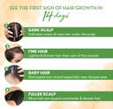 WOW Skin Science Rosemary With Biotin Shampoo - 250 ML Image
